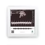 تابلو صدانما ضربان قلب نوزاد