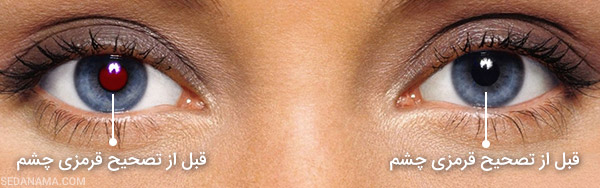 رفع قرمزی چشم